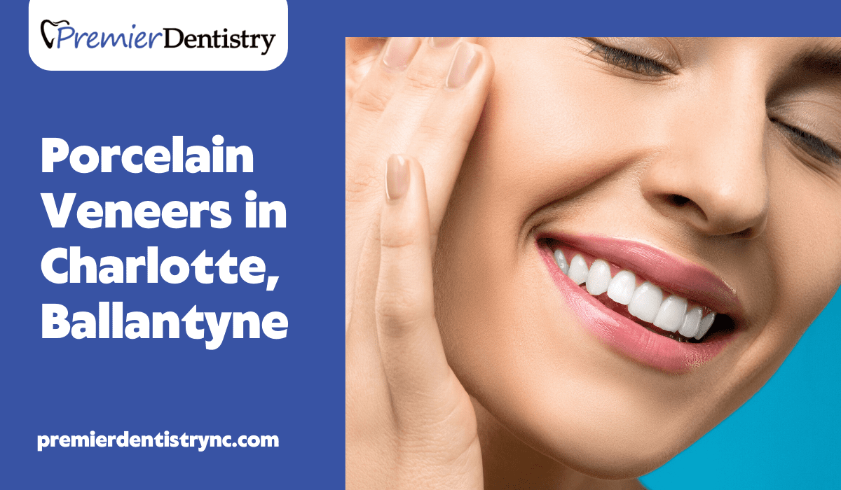 Porcelain Veneers in Charlotte, Ballantyne