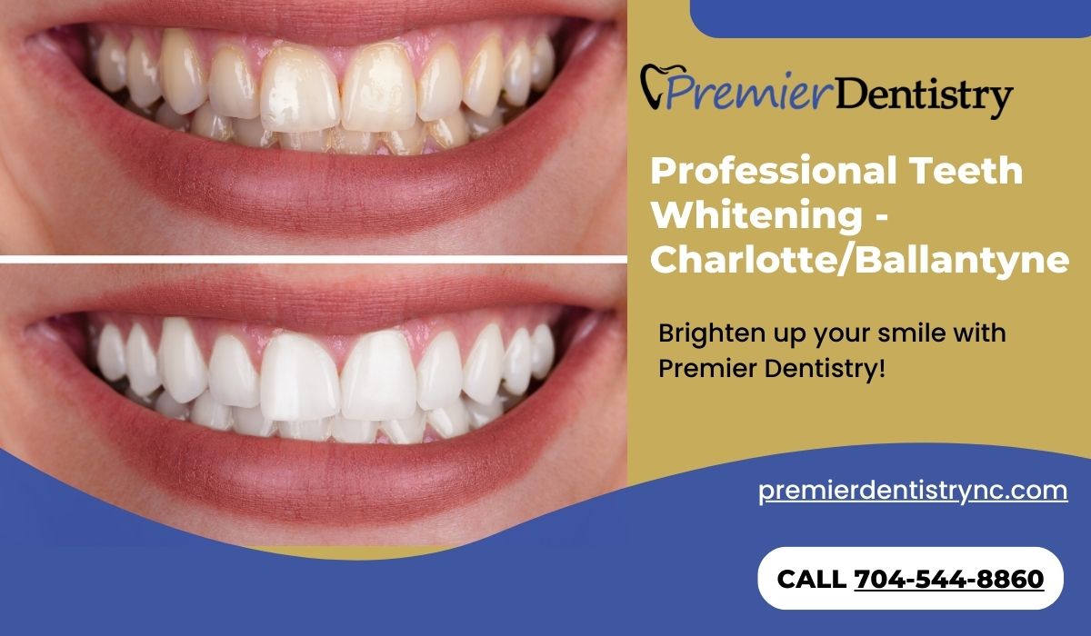 Professional Teeth Whitening - Charlotte/Ballantyne