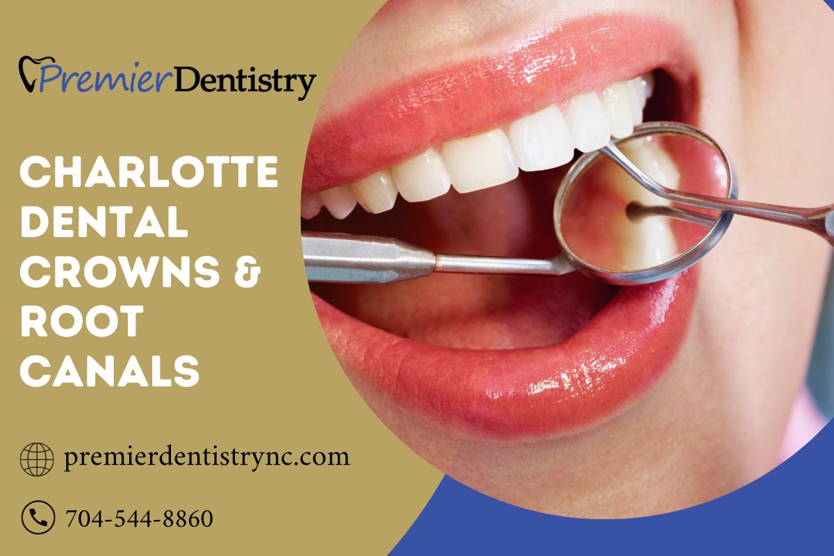 Charlotte Dental Crowns & Root Canals