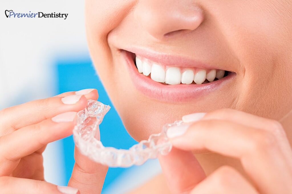 Invisalign