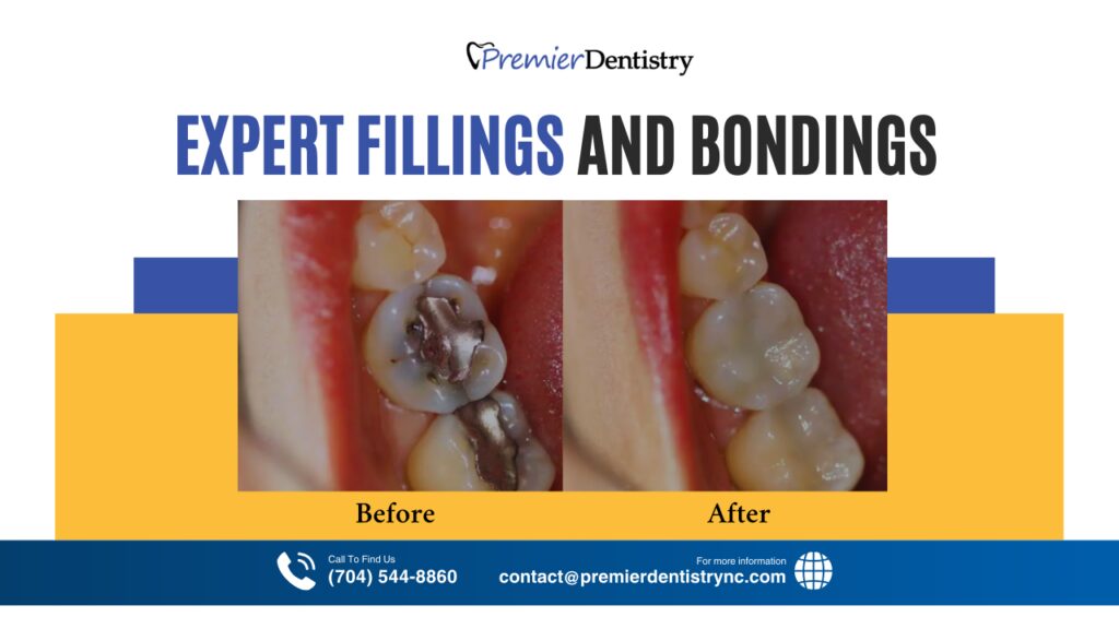 Restore Your Smile with Expert Fillings and Bondings in Charlotte