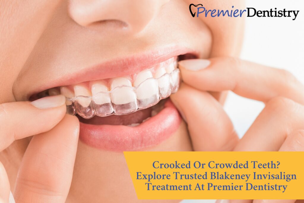 Crooked Or Crowded Teeth? Explore