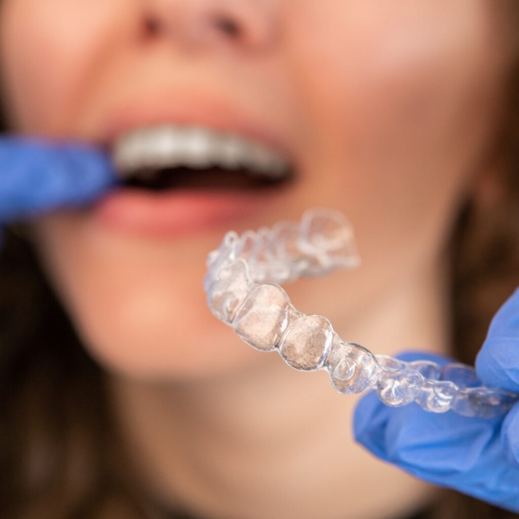 Blakeney Invisalign Treatment For Adults And Teens Seeking A Straighter Smile Without Braces